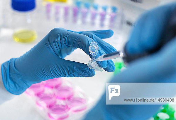 Biotechnologische Forschung  Wissenschaftler pipettiert Probe in ein Fläschchen zur Analyse im Labor  Nahaufnahme der Hände