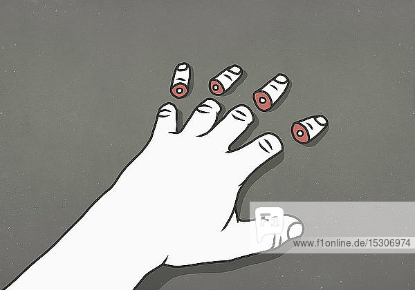 Mann mit abgetrennten Fingerspitzen