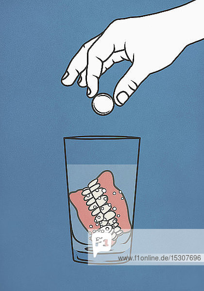 Prothesenreinigungstabletten von Hand in ein Glas Wasser mit Prothesen eintropfen lassen