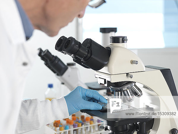 Medizinisches Screening  Wissenschaftlerin untersucht einen Objektträger mit einer menschlichen Probe unter einem Mikroskop und einer Blutprobe