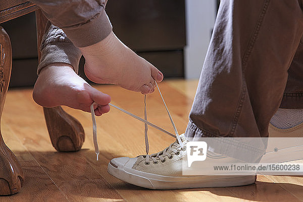 Frau mit TAR-Syndrom bindet den Schuh ihres Mannes mit ihren Füßen