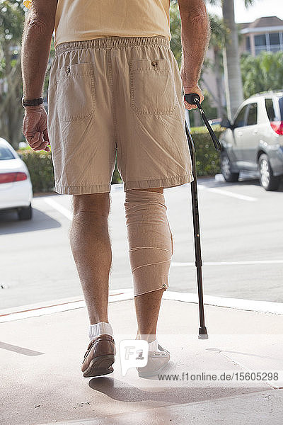 Älterer Mann mit Verband am Bein  der mit Hilfe eines Stocks geht