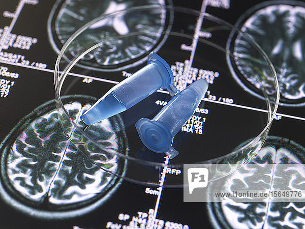 Klinische Proben aus einem Forschungsprojekt  die in Fläschchen mit Hirnscan-Bildern enthalten sind  Forschung über Alzheimer und demenzielle Erkrankungen.