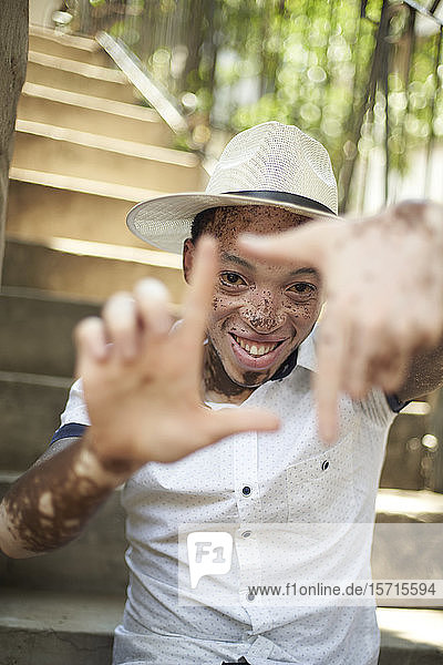 Porträt eines jungen Mannes mit Vitiligo  der einen Hut trägt und auf der Treppe sitzt und sein Gesicht mit den Händen umrahmt