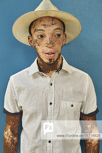 Porträt eines jungen Mannes mit Vitiligo  der einen Hut trägt  blaue Wand im Hintergrund