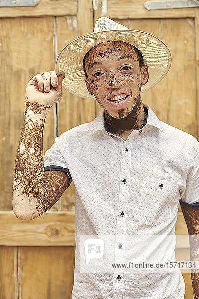 Porträt eines jungen Mannes mit Vitiligo  der einen Hut trägt