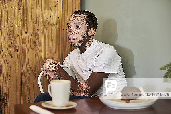 Junger Mann mit Vitiligo sitzt in einer Cafeteria mit einem Kaffee und einem Muffin auf dem Tisch