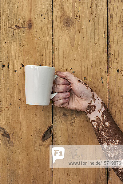 Nahaufnahme der Hand eines Mannes mit Vitiligo  der eine Tasse Kaffee an einer Holzwand hält