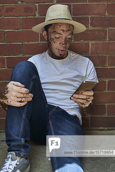 Porträt eines jungen Mannes mit Vitiligo  der einen Hut trägt und auf dem Boden sitzend sein Telefon überprüft