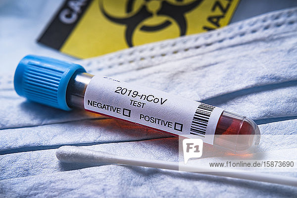 2019-nCoV Coronavirus-Teströhrchen mit Biohazard-Symbol