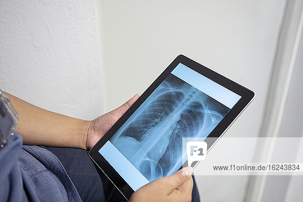 Hände halten digitales Tablet mit Röntgenbild
