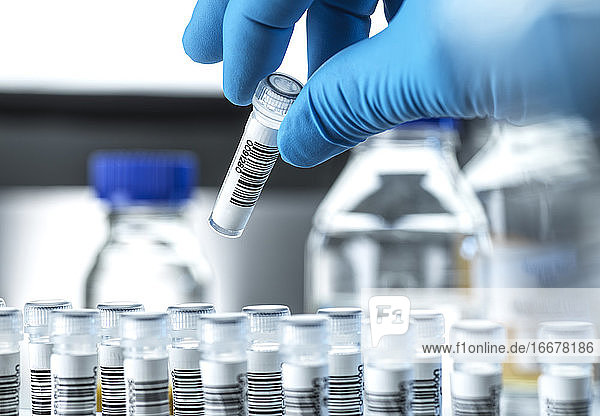Klinische Tests  DNA-Probe wird für den Test im Labor vorbereitet.
