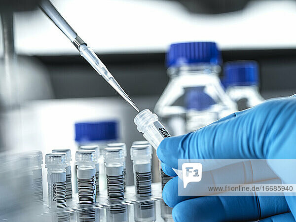 Klinische Tests  DNA-Probe wird für den Test im Labor vorbereitet.