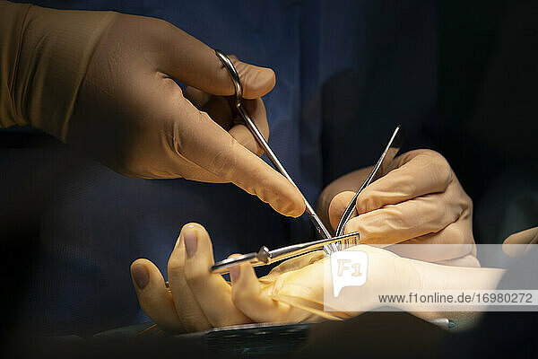 ein Chirurg operiert eine Hand