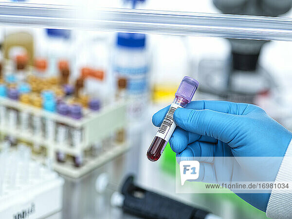 Medizintechniker bei der Vorbereitung menschlicher Proben für medizinische Tests im Labor