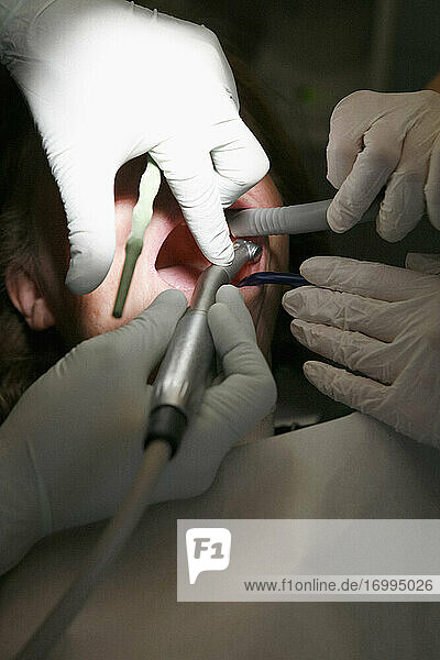 Close up Frau erhalten Zahnreinigung in Zahnarztpraxis