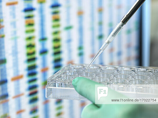 DNA-Wissenschaften  Wissenschaftler  der eine Probe in eine Multi-Well-Platte pipettiert  die für die automatische Analyse im Alterslabor bereit ist  mit den DNA-Ergebnissen auf dem Bildschirm
