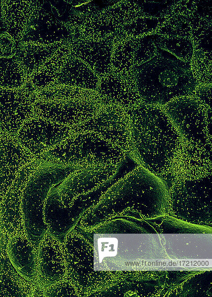 Ebola-Virus aus malischer Blutprobe