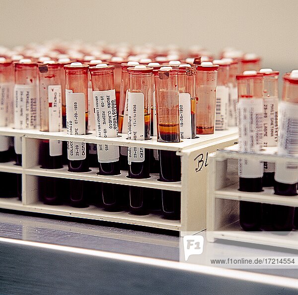 Stillleben; Gesundheit  Biologie Medizin  Proben  Analysen Blut Analyse  Blutanalyse| Health  biology  samples  analyzes  blood analysis
