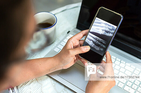 Frau betrachtet ihr Röntgenbild auf dem Mobiltelefon zu Hause  Konzept des virtuellen Arztes.
