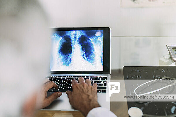 Männlicher Arzt mit Laptop bei der Arbeit an einem Röntgenbild in einer Klinik