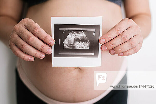 Pregnant woman holding an ultrasound of her baby.