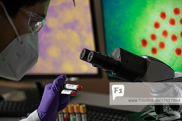 Blood tests to detect hepatitis B (HBC) and C (HCV)  viruses visible on the screen.