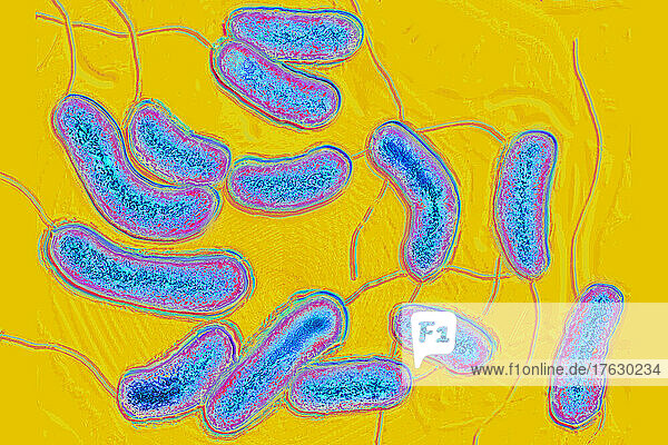 Bacilli Vibrio cholera. Cholera is an infectious and contagious disease  characterized by sudden diarrhea. Left untreated  the main form of cholera is fatal. Image taken from an X 1000 optical microscopy view.