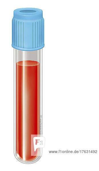 Test tube containing blood  sample  medical examination.
