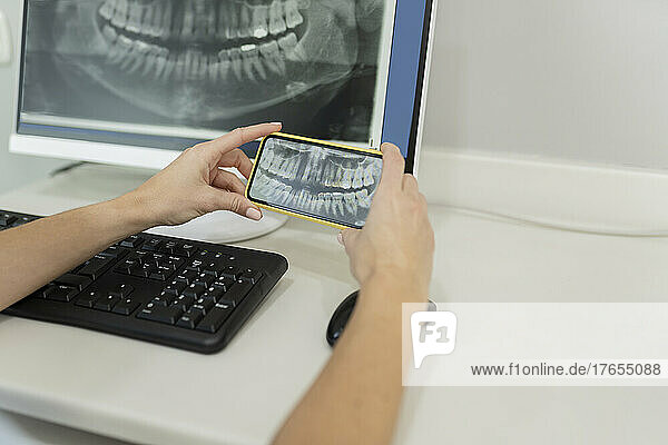 Dentist examining x-ray image through smart phone at dental clinic
