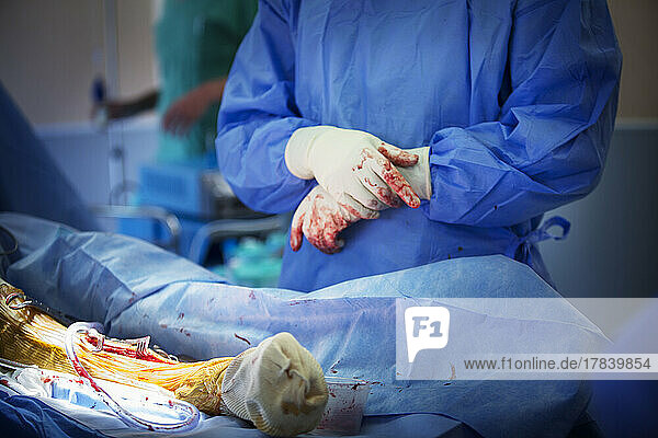 Orthopedic surgery operating room for the removal of external fixations of the tibia.