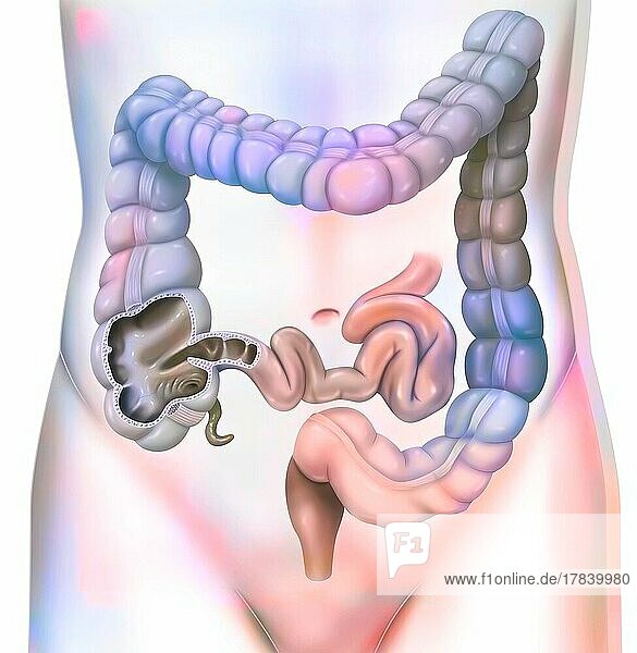 Digestive system: the colon or large intestine.