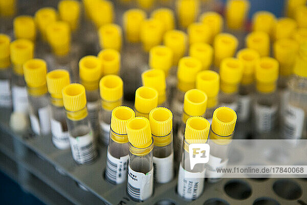Hospital microbiology analysis laboratory  urine samples.