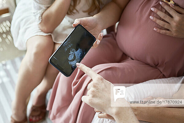 Hand of pregnant woman showing ultrasound result on smart phone to friends