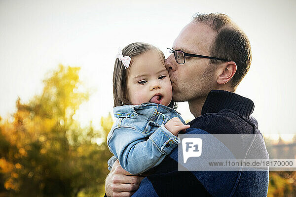 Vater hält und küsst seine kleine Tochter  die das Down-Syndrom hat  in einem Park während der Herbstsaison; St. Albert  Alberta  Kanada
