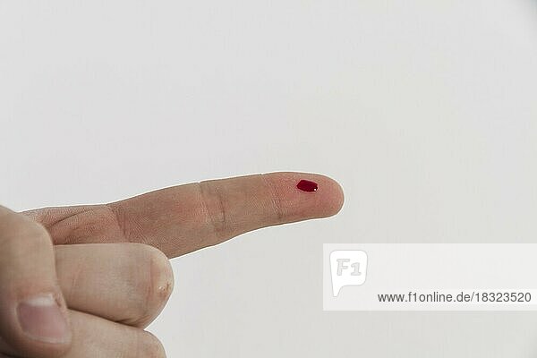 Blutende Finger