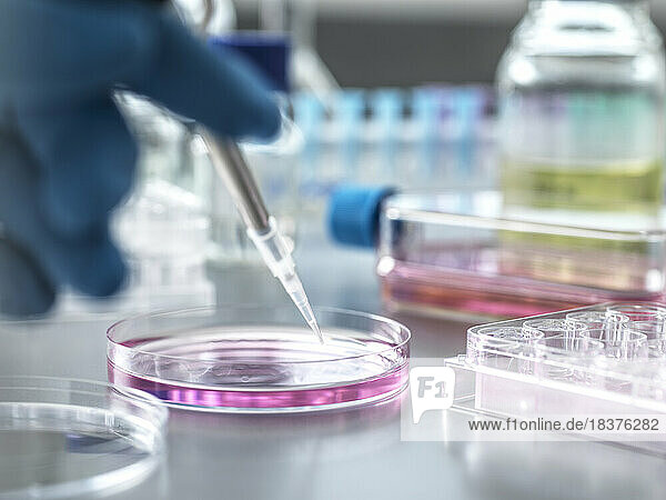 Scientist pipetting medical samples into petri dish in laboratory