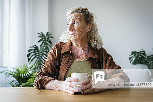 Worried senior woman holding mug sitting at home