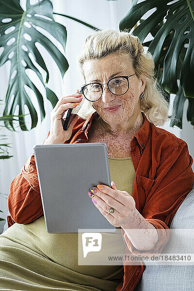 Smiling woman with vitiligo skin using wireless technologies sitting at home