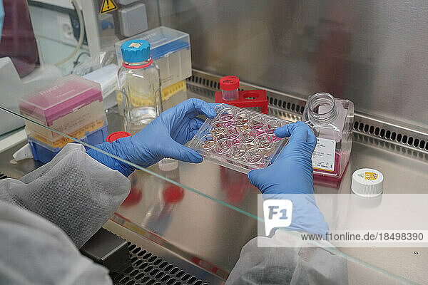 Research on chronic bacterial infections within Inserm. PhD student working on brucellosis bacteria.