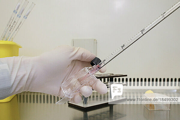 Cytogenetics laboratory  culture of amniotic fluid samples (flasks).