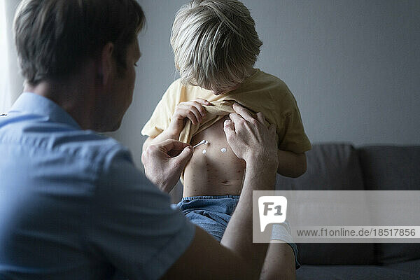 Father applying ointment on son's chickenpox at home