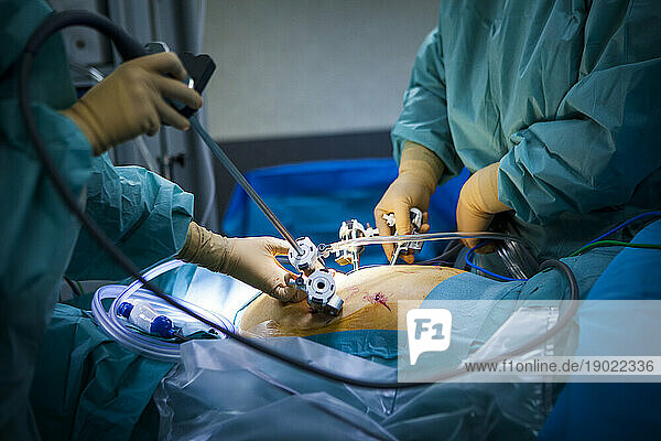 Hysterectomy in the operating room with a robot surgeon  installation of the four arms of the robot including a camera.