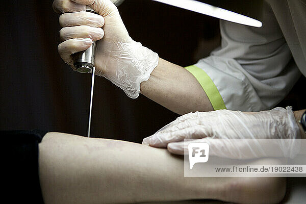 Laser scar-free tattoo removal session in a beauty salon.