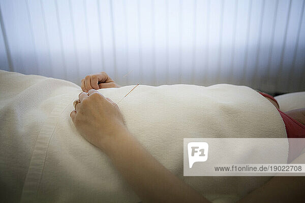 Chinese medicine practice  acupuncture on a patient undergoing chemotherapy in the hospital.