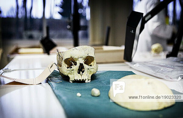 Criminal research by the forensic science in the anthropology thanatology odontology department.
