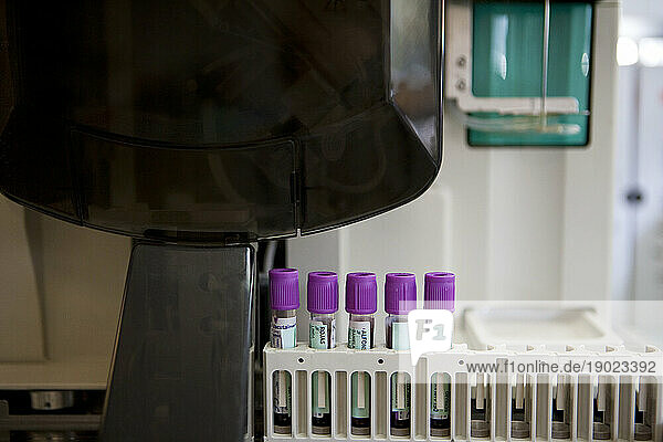 Hematology machine in the analysis laboratory of a hospital.
