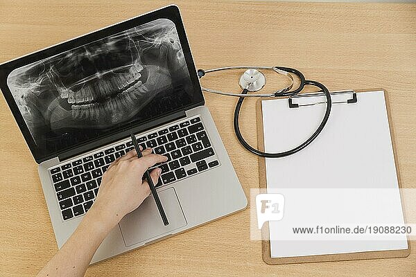 Radiographie Laptop