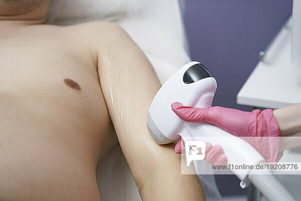 Man getting laser hair removal of arm at clinic