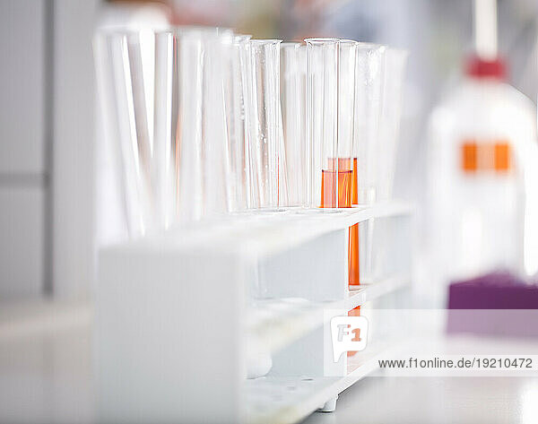 Test tubes with medical sample in laboratory